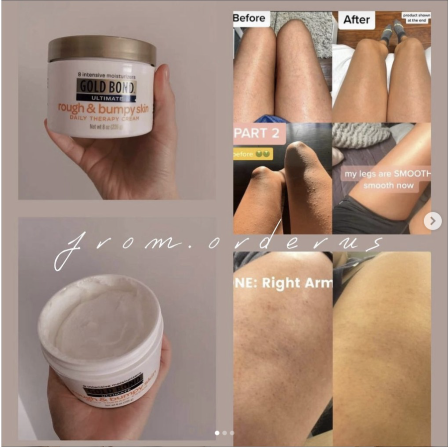 [AUTH] KEM DƯỠNG DA GOLD BOND ULTIMATE ROUGH & BUMPY SKIN