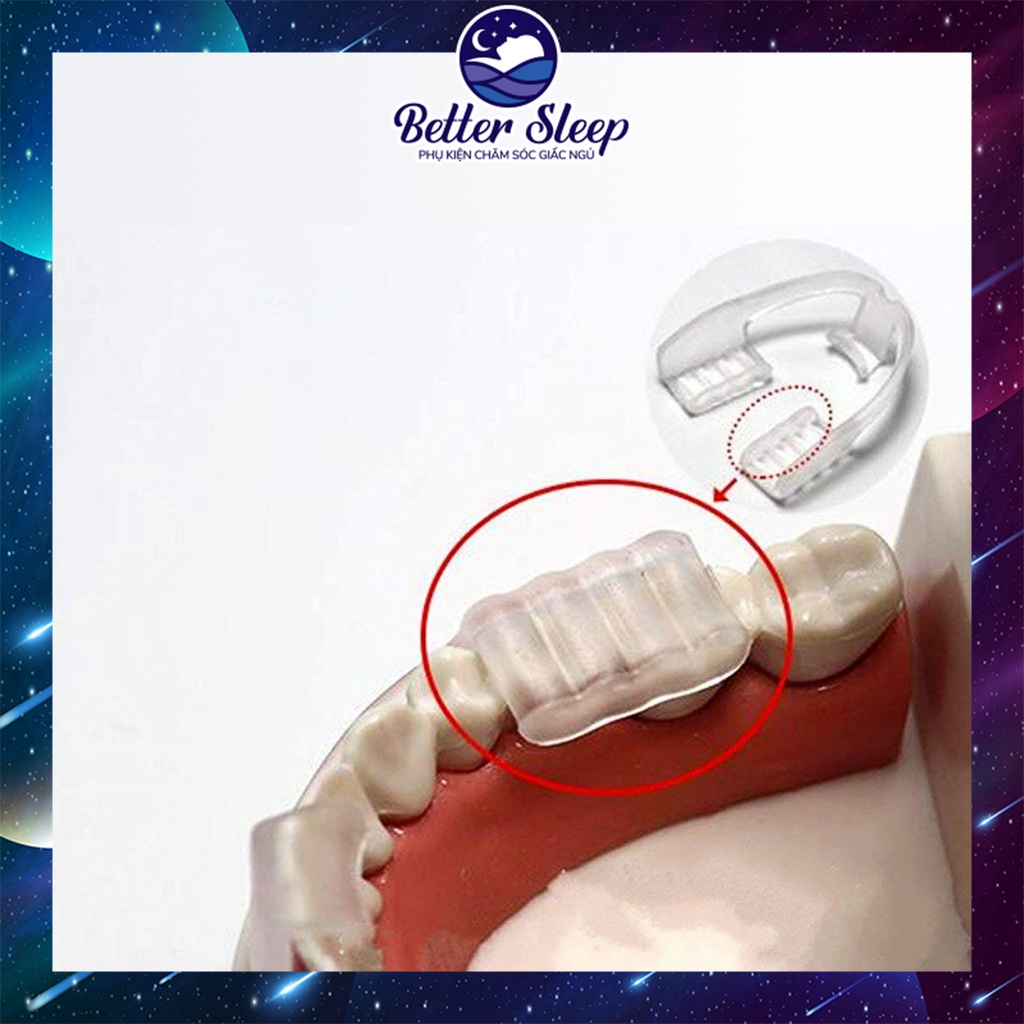 DỤNG CỤ CHỐNG NGHIẾN RĂNG, BẢO VỆ RĂNG MIỆNG SILICON #9 #CNN - [HI5 CARE]