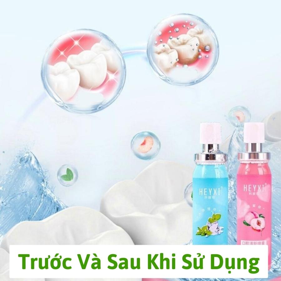 Xịt thơm miệng Heyxi Xịt thơm miệng thảo mộc