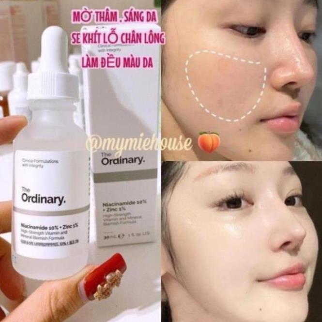 Serum the ordinary niacinamide 10% + zinc 1% giảm mụn giảm thâm se khít lỗ chân lông