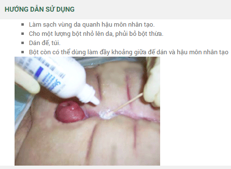 KEO - BỘT CHỐNG RÒ RỈ, CHỐNG LOÉT STOMAHESIVE PASTE CONVATEC