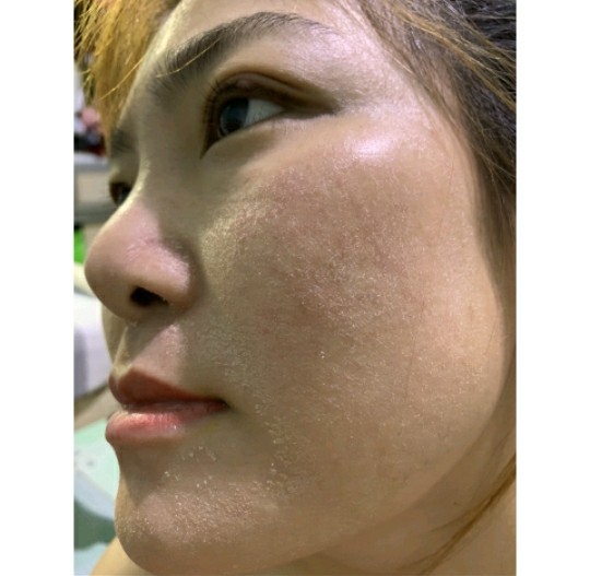 SERUM THẢO DƯỢC SẠCH NÁM MAY NEW 50ML