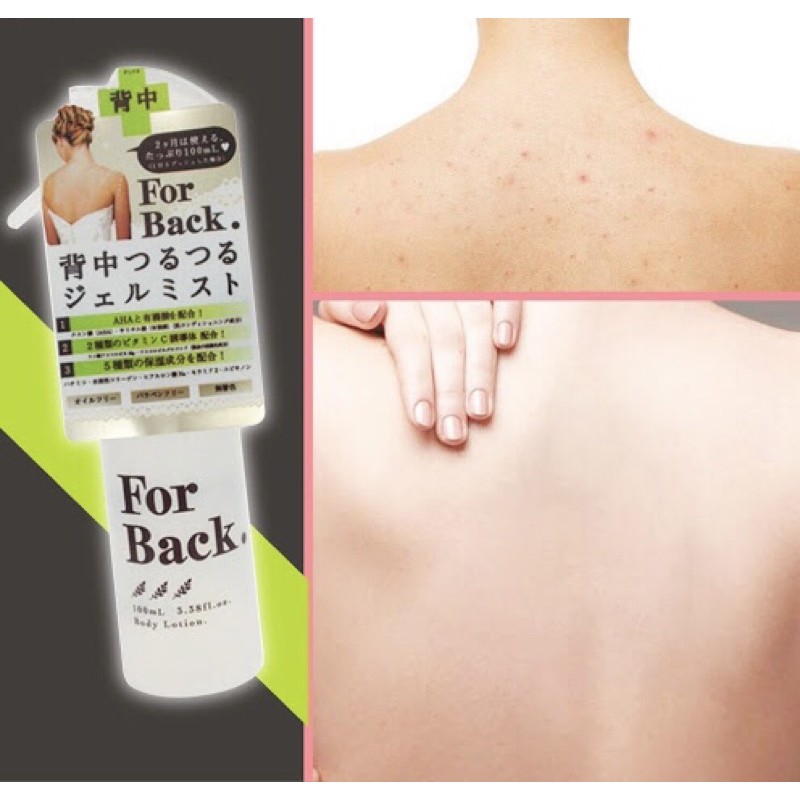 Chai Xịt giảm mụn For Back Body Lotion