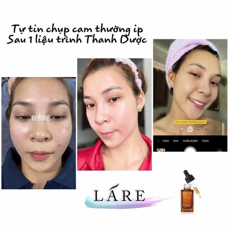 Serum thảo mộc Thanh Dược Lare 80ml