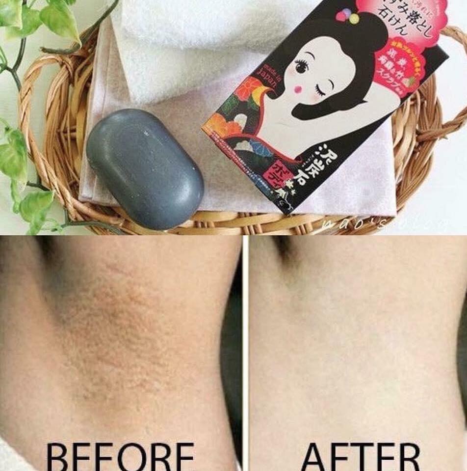 Xà Phòng Thâm Nách Pelican Cleansing Soap For Black Spots