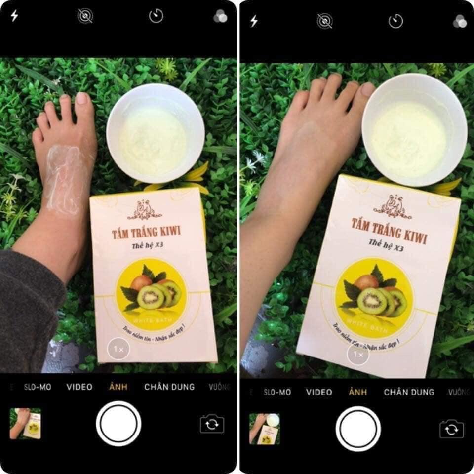 TẮM TRẮNG KIWI THẾ HỆ X3