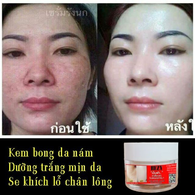 [HCM]KEM KÍCH BONG DA THAILAN