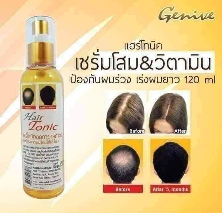 Xịt Mọc Tóc, Hói Đầu GENIVE HAIR TONIC Thái Lan