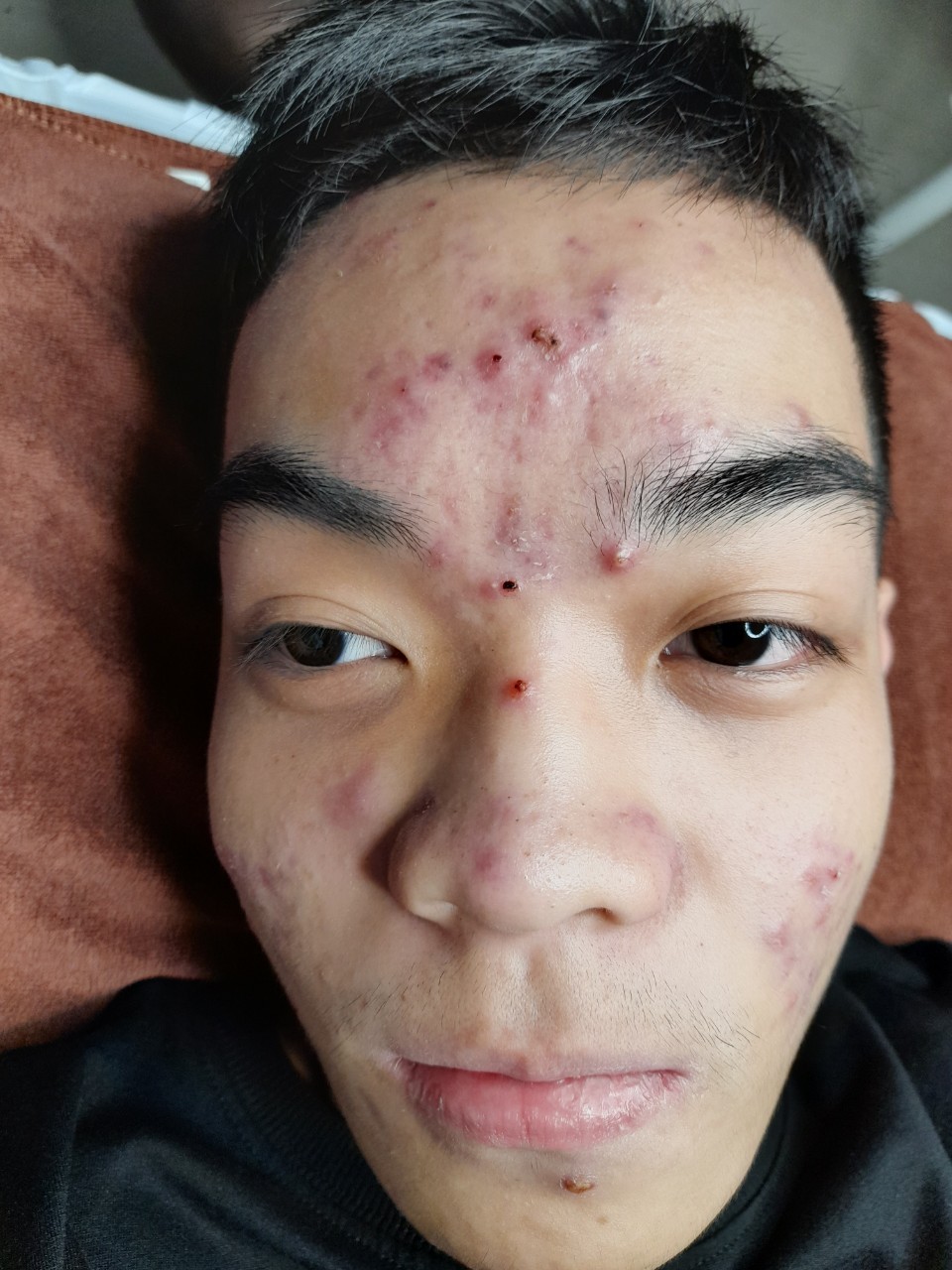 Noãn thực vật QA Beauty