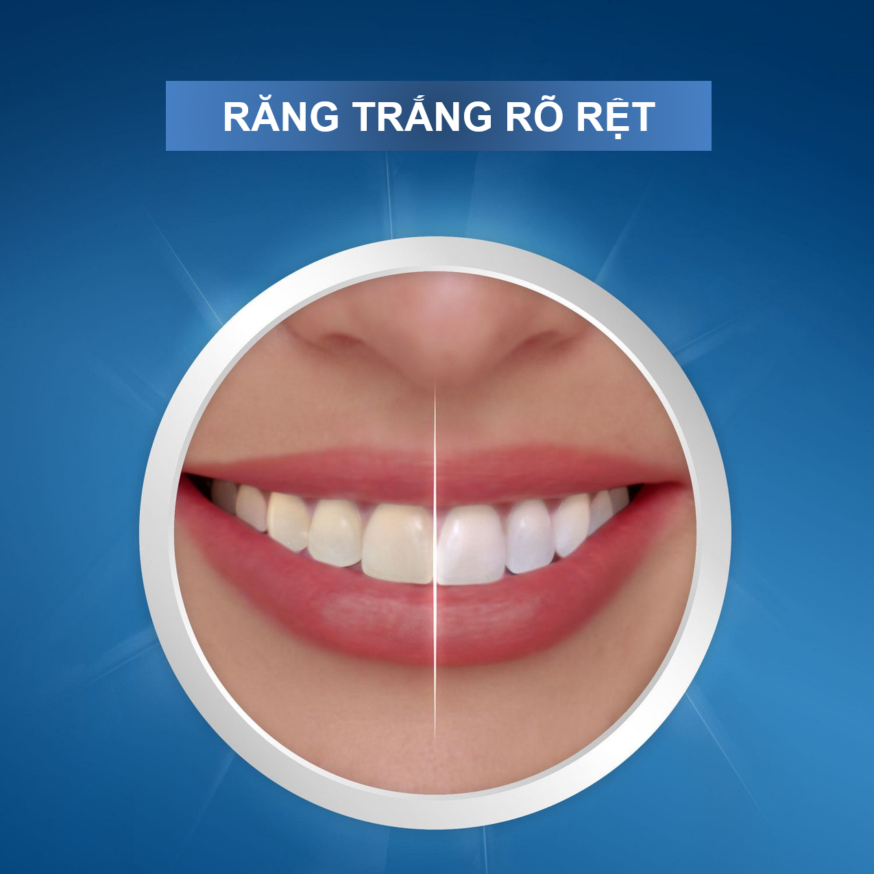 Miếng Dán Trắng Răng Oral-B 3DWhite WhiteStrips