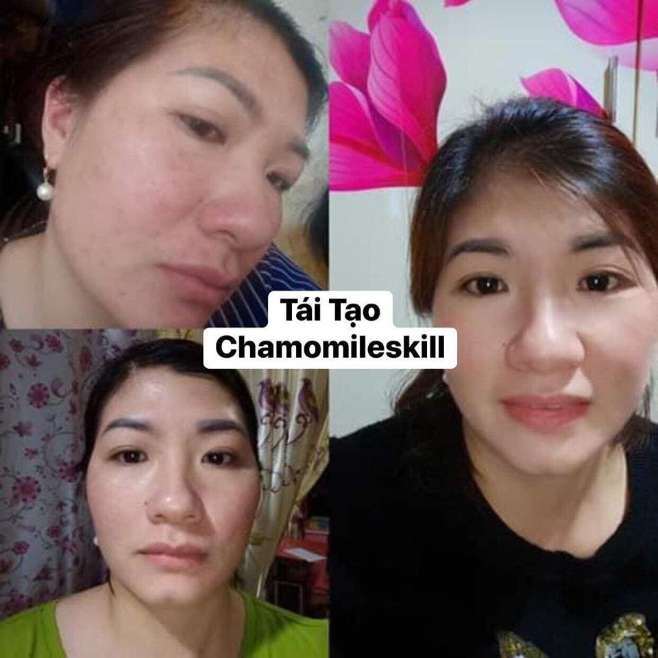 [HCM]Kem tái tạo Chamomileskill
