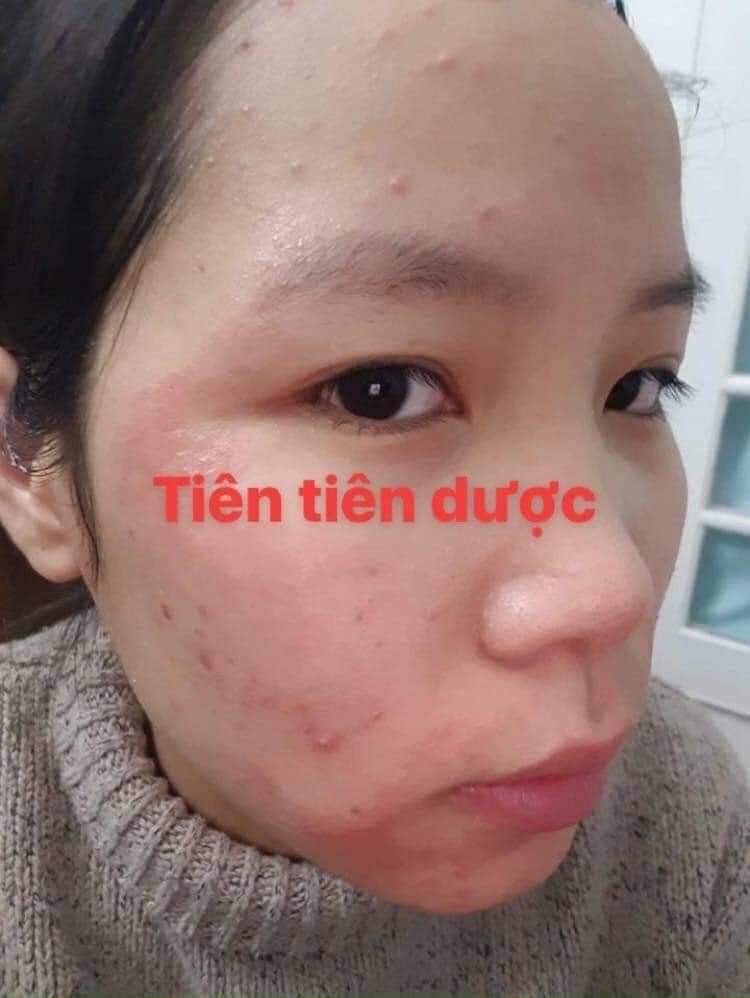 tiên tiên dược