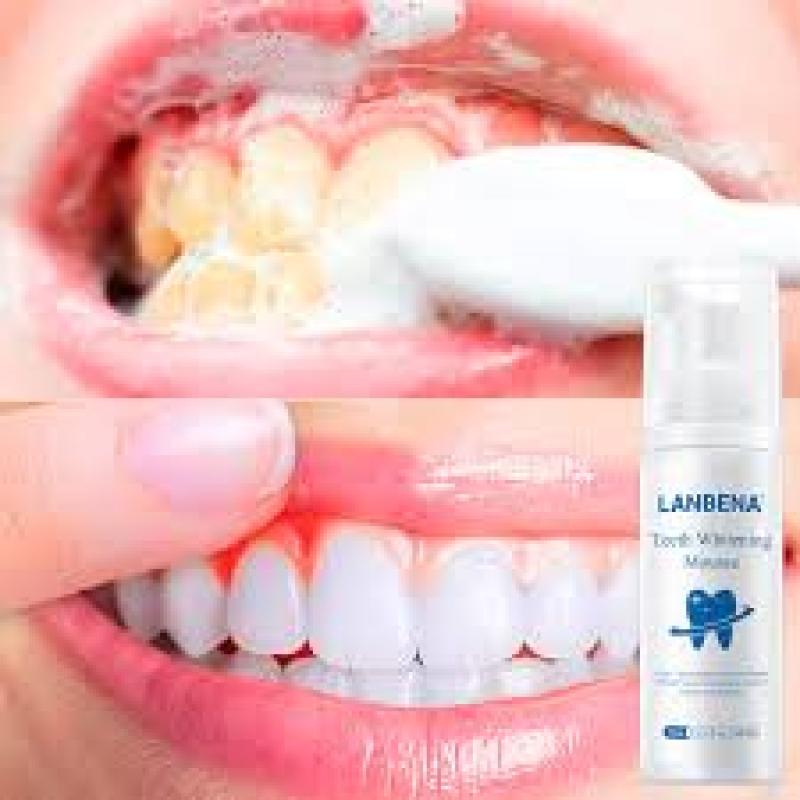 LANBENA Tinh chất tẩy trắng răng Mousse khử mùi hôi miệng kem đánh răng làm sạch răng tẩy vết ố Whitening Teeth Toothpaste cao cấp