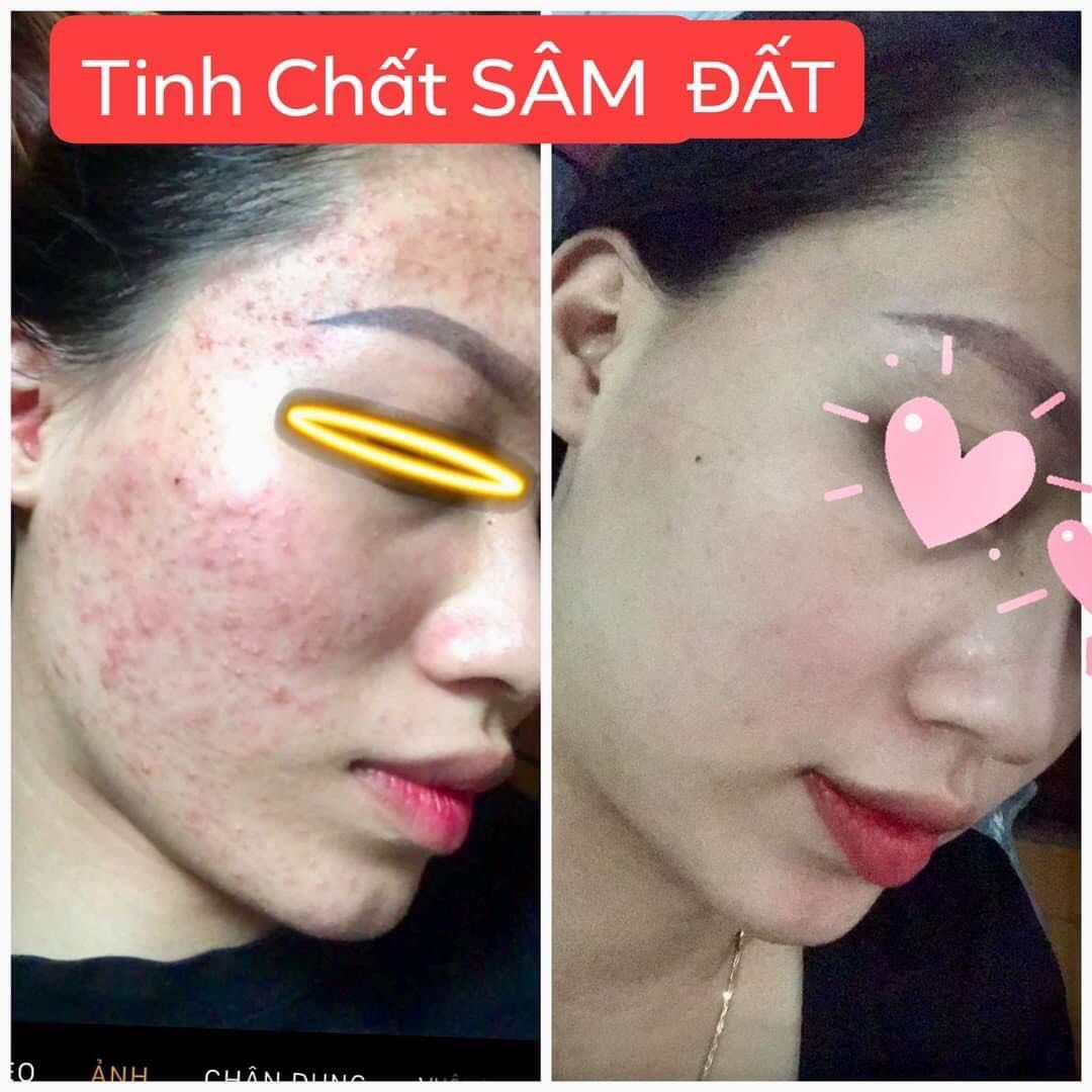 Tinh Chất Sâm Đất