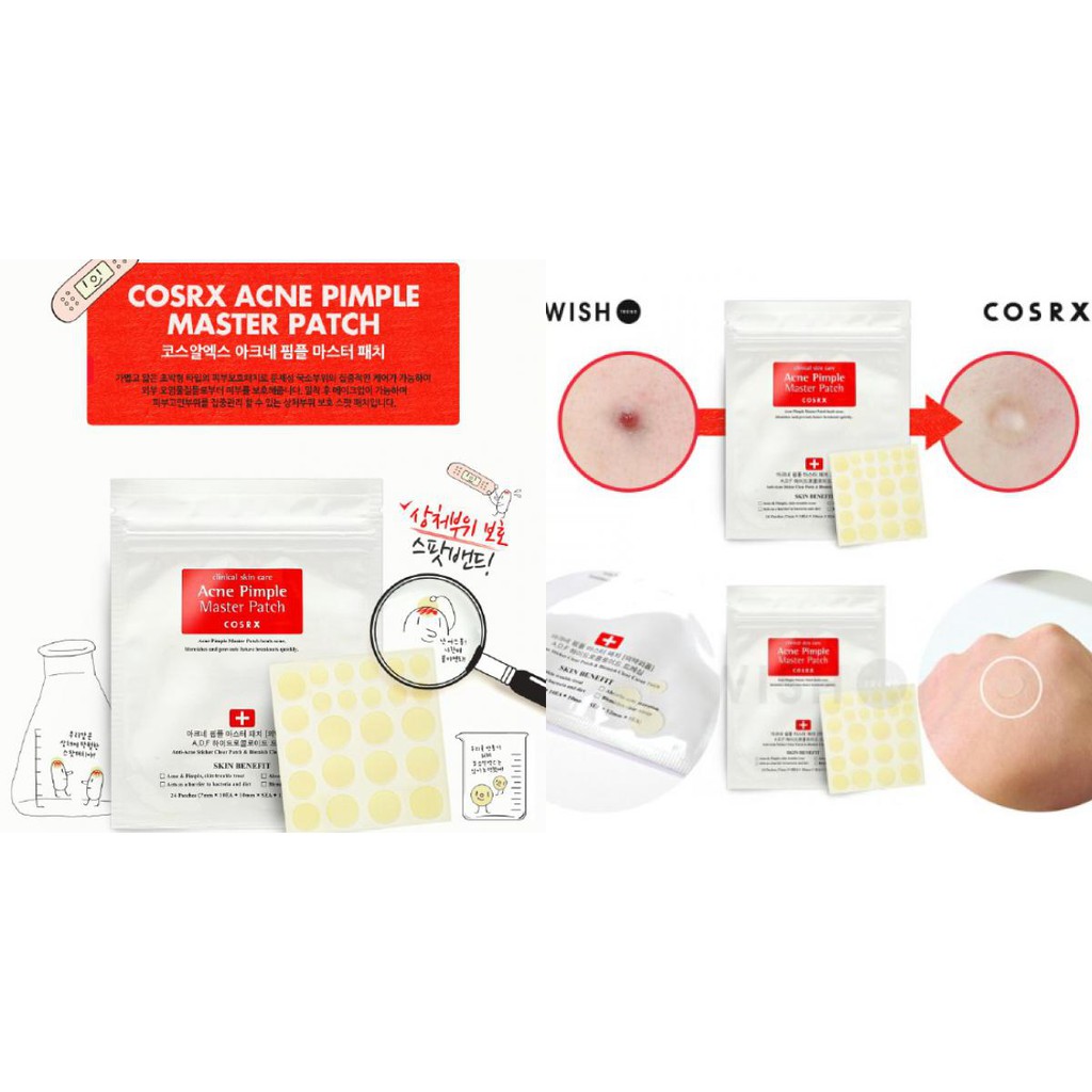 Miếng Dán Hút Mụn COSRX Acne Pimple Master Patch