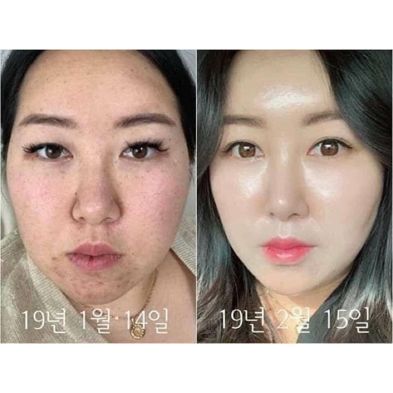 Serum Esthemax Vitamin C 561 100ml