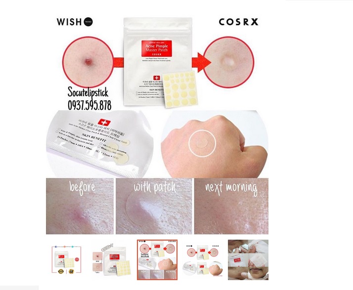 Miếng Dán Mụn COSRX Hàn Quốc