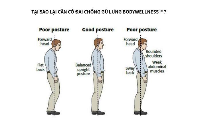 - Đai chống gù lưng BODYWELLNESS -