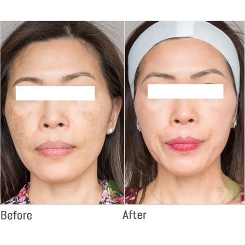 Kem Chống Nắng Eucerin Sun Serum Double Whitening SPF50
