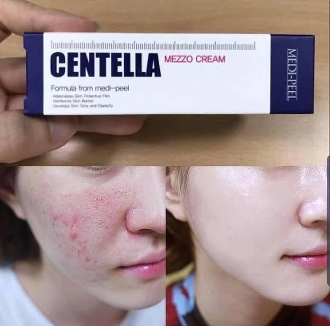 [HCM]Kem mụn Medi Peel Centella Mezzo Cream Hàn Quốc 30ml