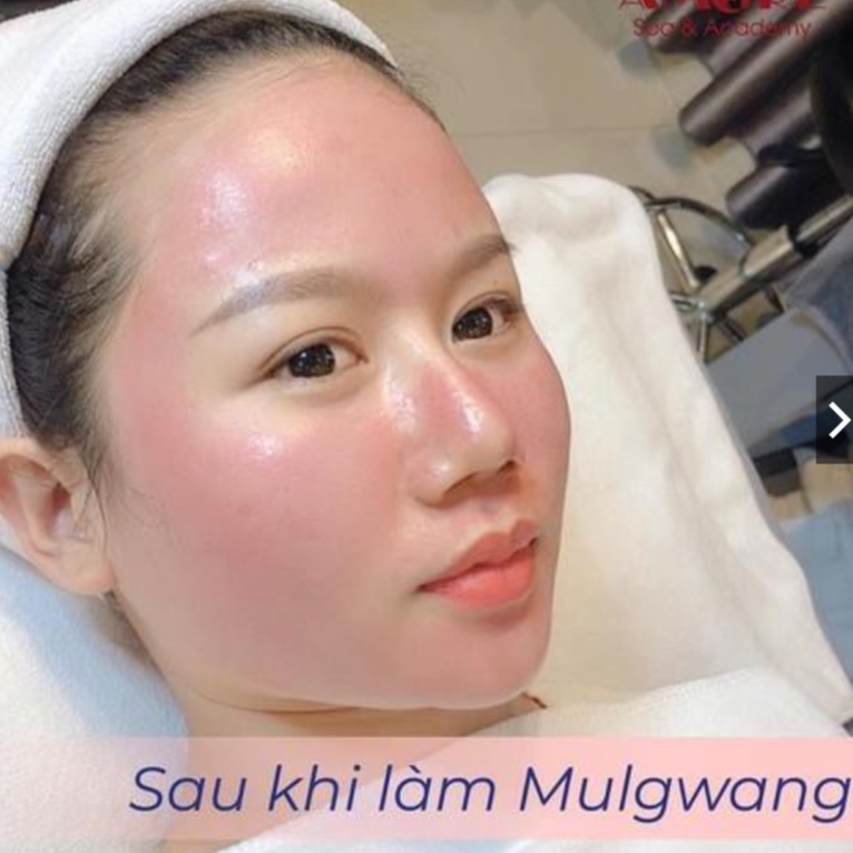 Mulwang x5 Serum Căng Bóng Hàn Quốc - SPA88