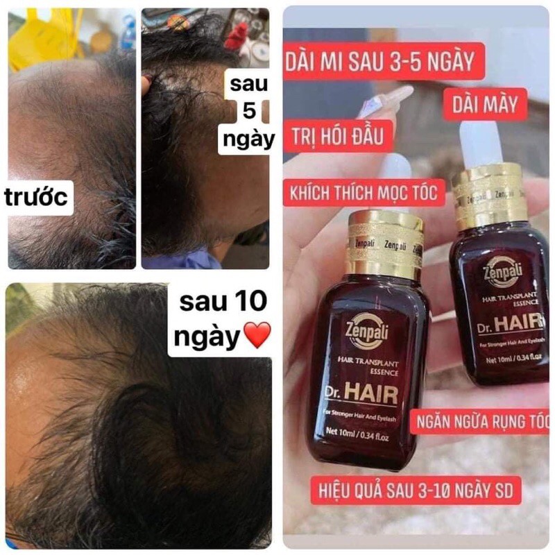 [HCM][CAM KẾT CHÍNH HÃNG] Tinh Chất Dài Mi Mọc Tóc Dr Hair Zenpali - MIPHAR2