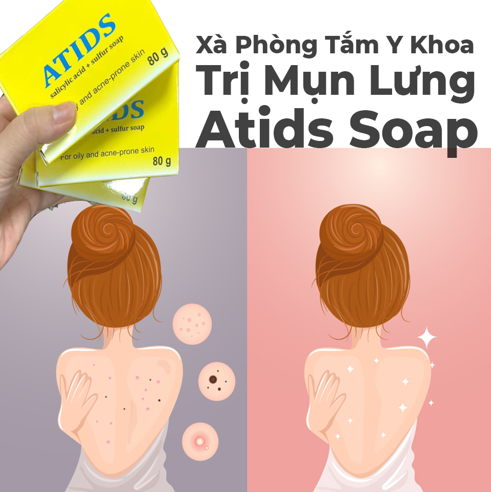 ATIDS - Xà phòng tắm giảm mụn lưng 80g