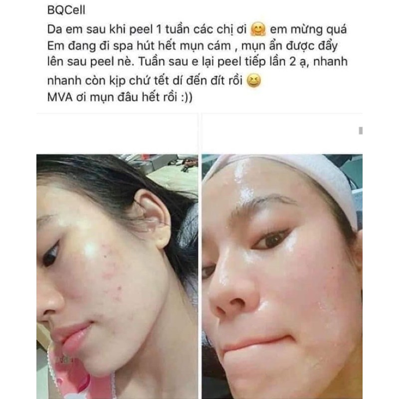 Vi Tảo Thay Da Sinh Học Thế Hệ Mới Hàn Quốc