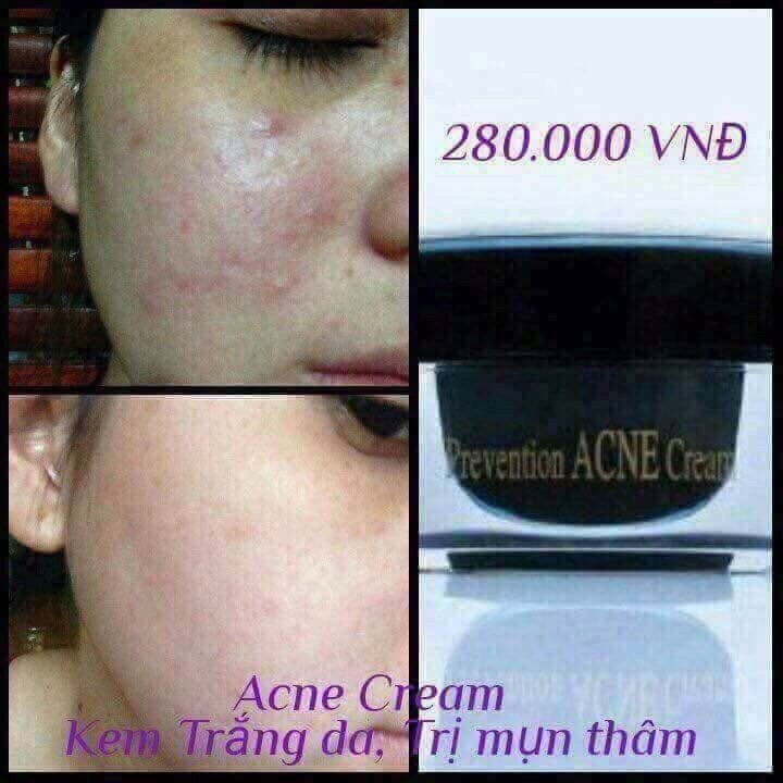 Kem Ngăn Ngừa Mụn Acne Dr Cell 30g dưỡng trắng mờ thâm mụn giảm mụn ngăn ngừa mụn