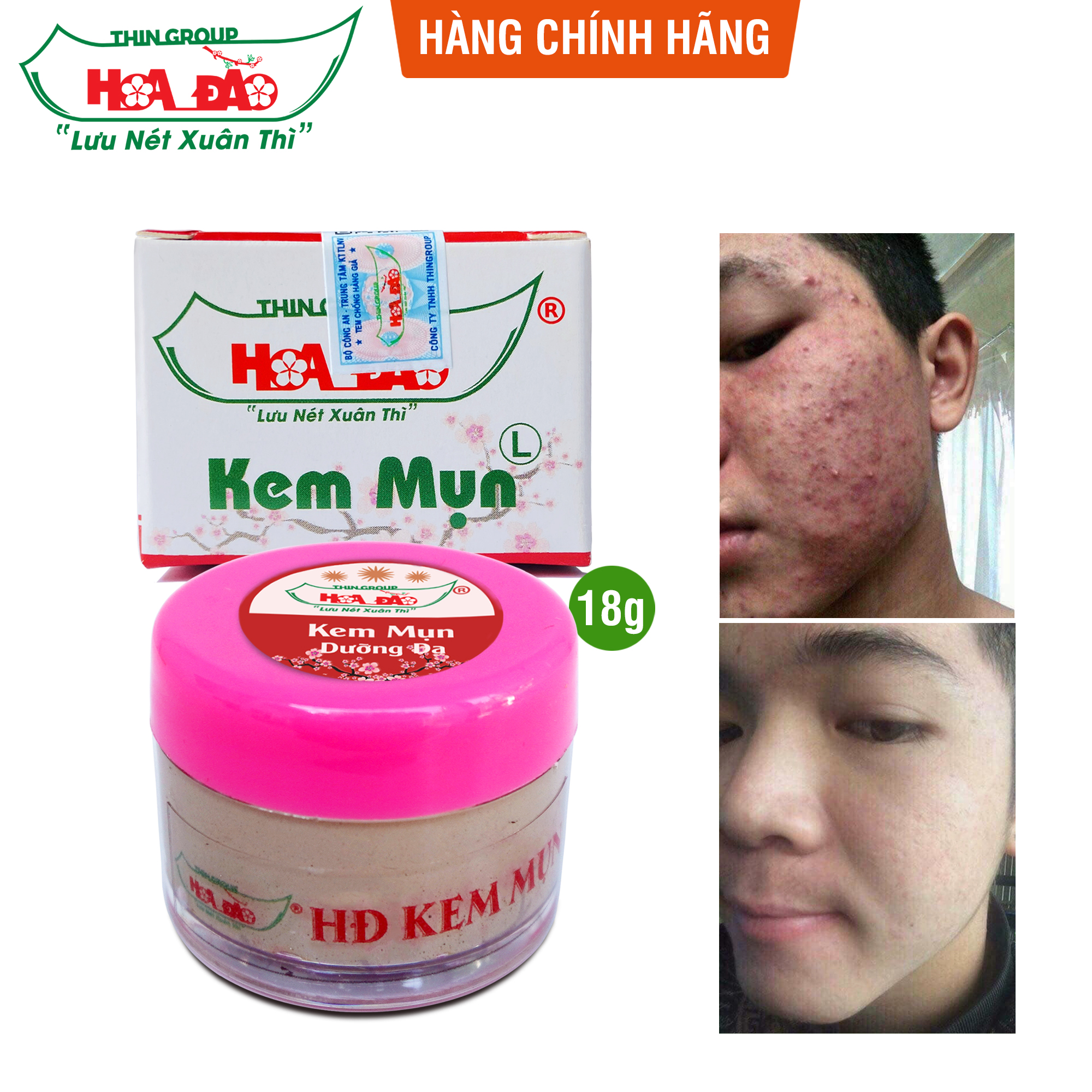 Kem giảm mụn, ngừa thâm và dưỡng da Hoa Đào 18g