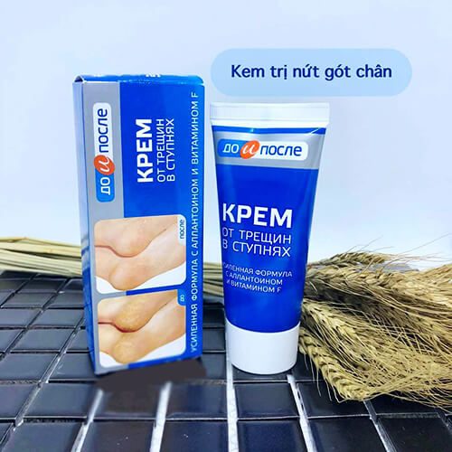 Kem Nứt Gót Chân Nga Kpem