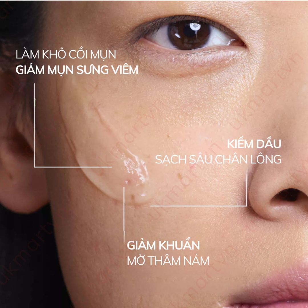 Gel bôi mụn cấp tốc Compliment No Problem 25ml SOS, AHA-BHA-PHA Tea Tree