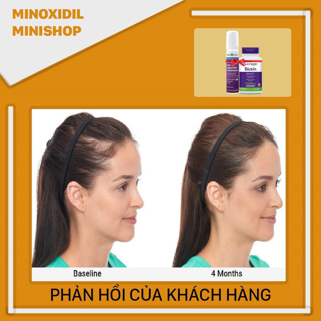 Minoxidil Basic Care for Women BỌT - Biotin mọc tóc, mọc lông vùng kín