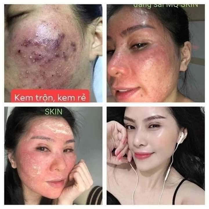 SERUM TÁI TẠO DA NHÂN SÂM MQ-SKIN ( chính hãng )