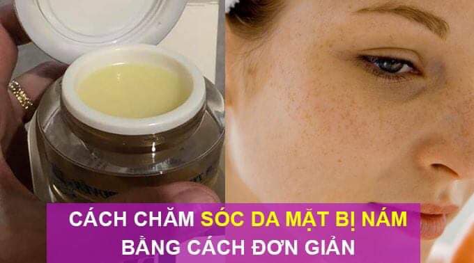 Kem chống lão hóa và làm đẹp da Bách Hoa Linh