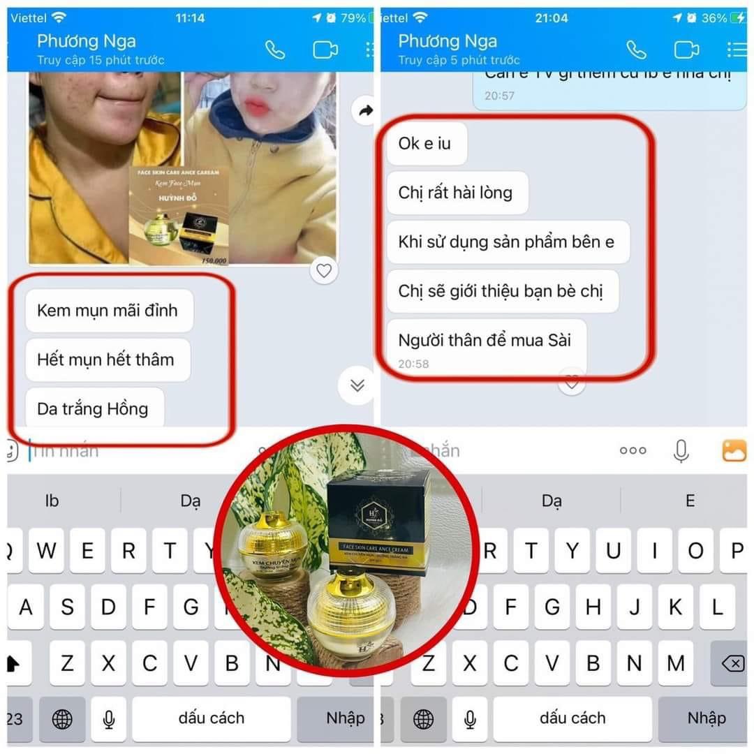 Kem FACE chuyên mụn - Trắng da HUỲNH ĐỖ