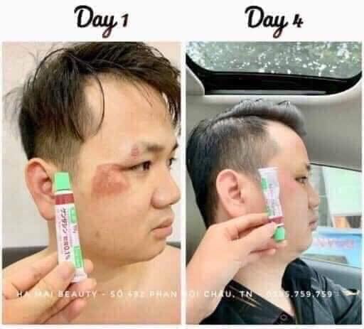 Kem Mờ Sẹo Gentacin Nhật 10g