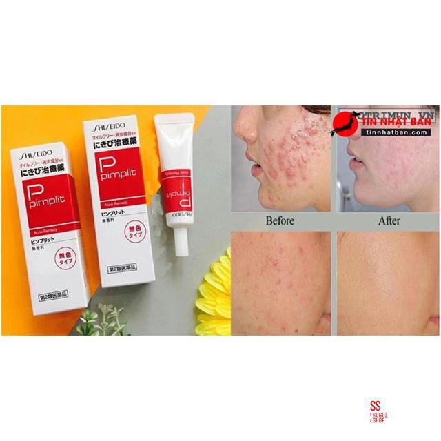 Kem làm giảm mụn Shiseido pimplit Nhật Bản