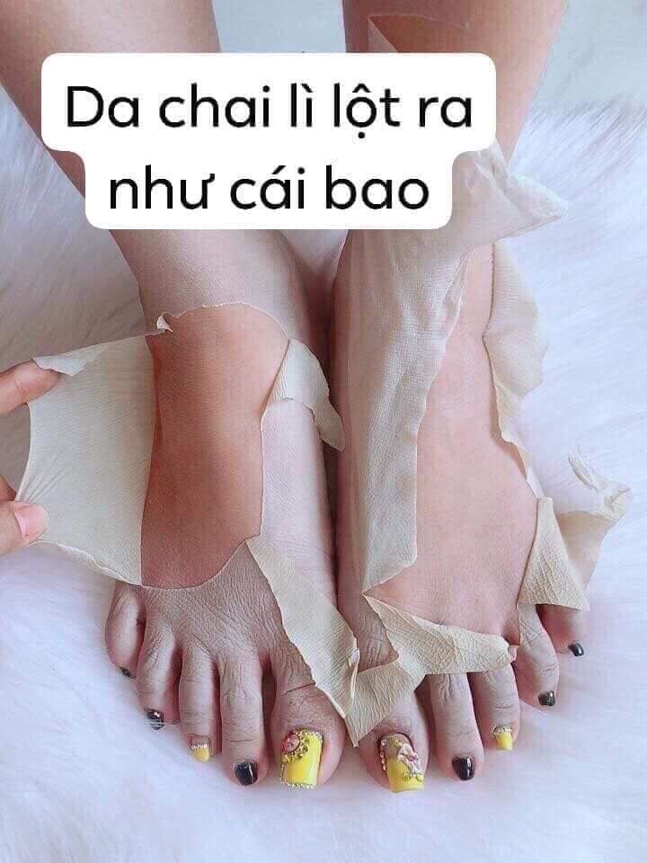 Lột da Nn