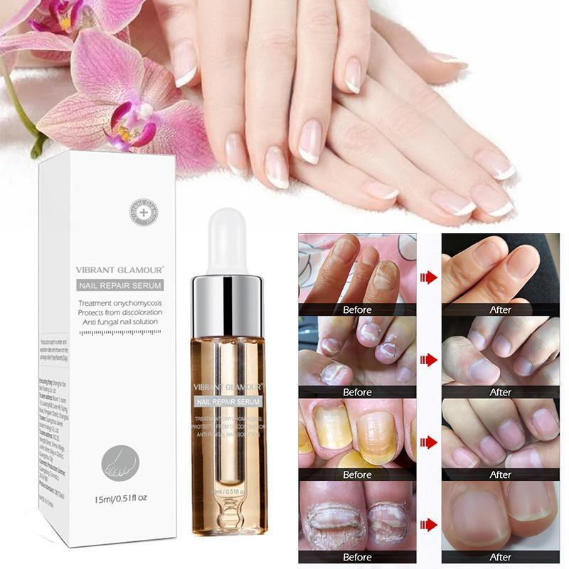 Nail Fungus Treatment Herb Nails Repair Cream Anti Infection Nail Foot Care Onychomycosis Removal Essence Nail Protector Serum