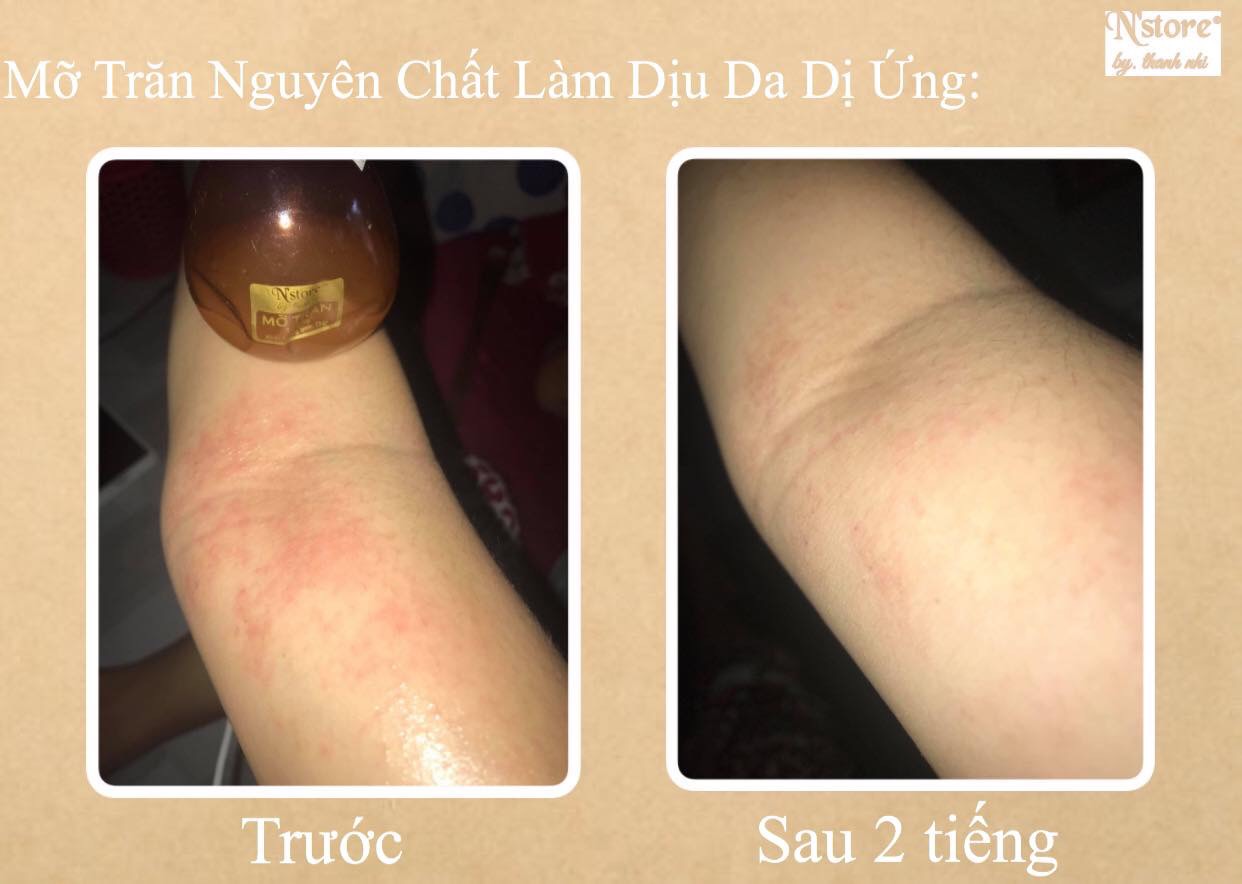 [HCM]MỠ TRĂN NGUYÊN CHẤT NSTORE BY THANH NHI