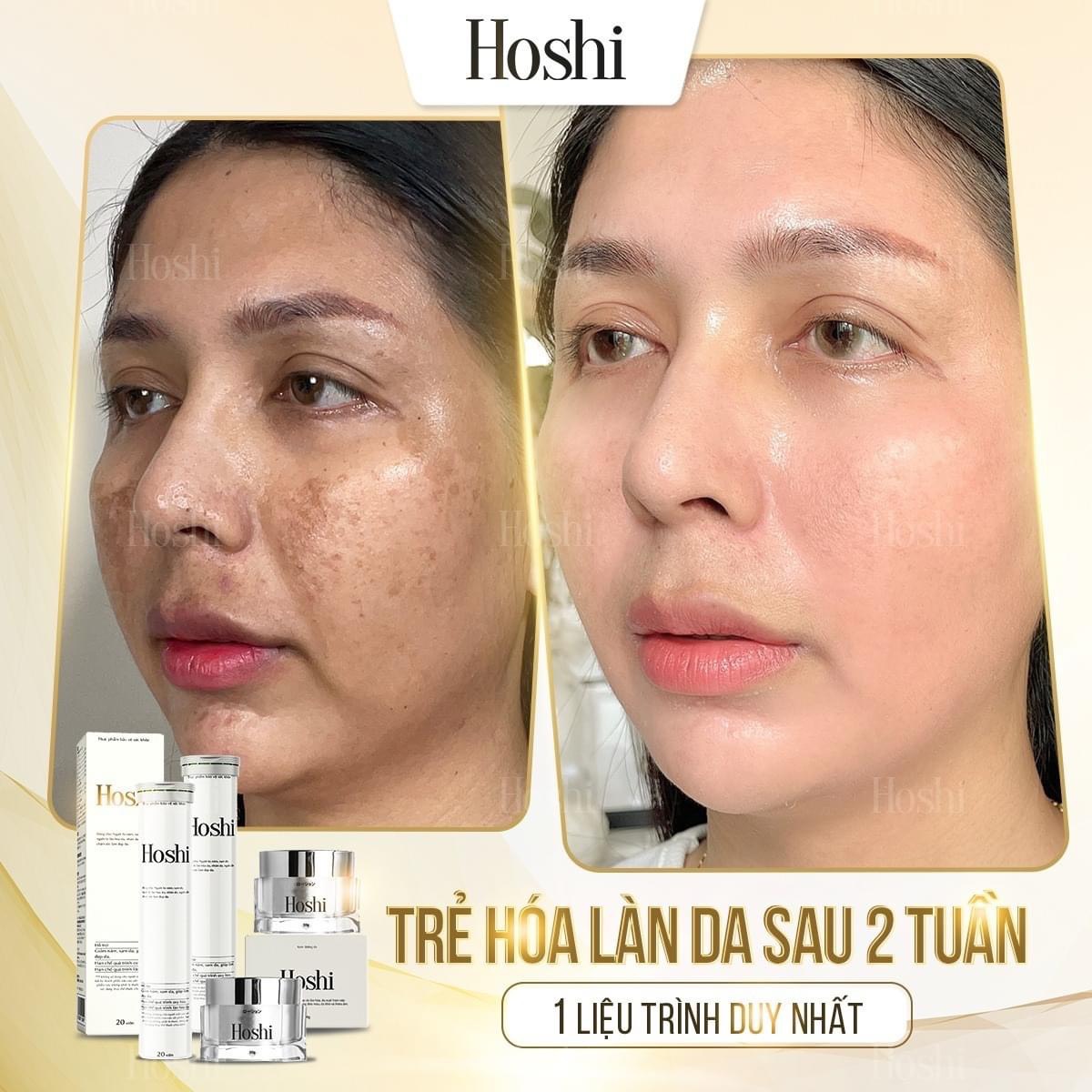 Bộ mờ nám, trắng da Hoshi Nhật Bản