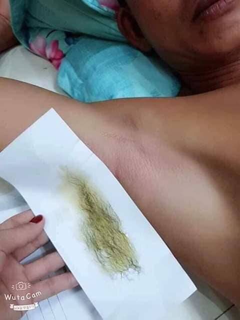 Combo Wax Lông+Mỡ Trăn Shiny Handmade (Tặng Kèm Giấy Wax Và Que Gạt)