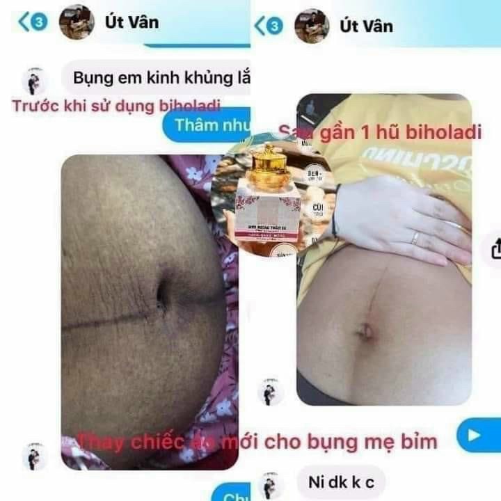 [HCM]Kem siêu dưỡng thâm 5S biho ladi 20g(chuyên khử thâm nách bẹn môngbikini và khử mùi)