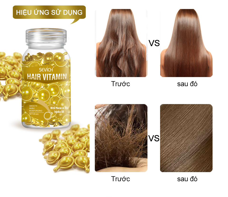 Viên Serum Dưỡng Tóc SEVICH Hair Vitamin 30 Viên Nuôi Dưỡng Giúp Phục Hồi Tóc Hư Tổn - intl