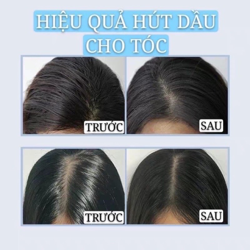 Xịt Dầu Gội Khô ISSY 150ML