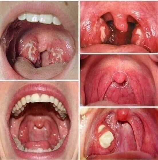 TINH DẦU DẠ THẢO LIÊN