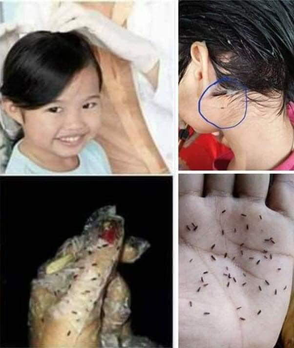 Thảo dược ủ chấy
