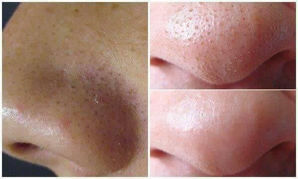 Lột Mụn Trà Xanh Collagen 2in1 Matcha Nhật  [TẶNG KÈM CỌ QUÉT MẶT NẠ SIÊU TIỆN LỢI]