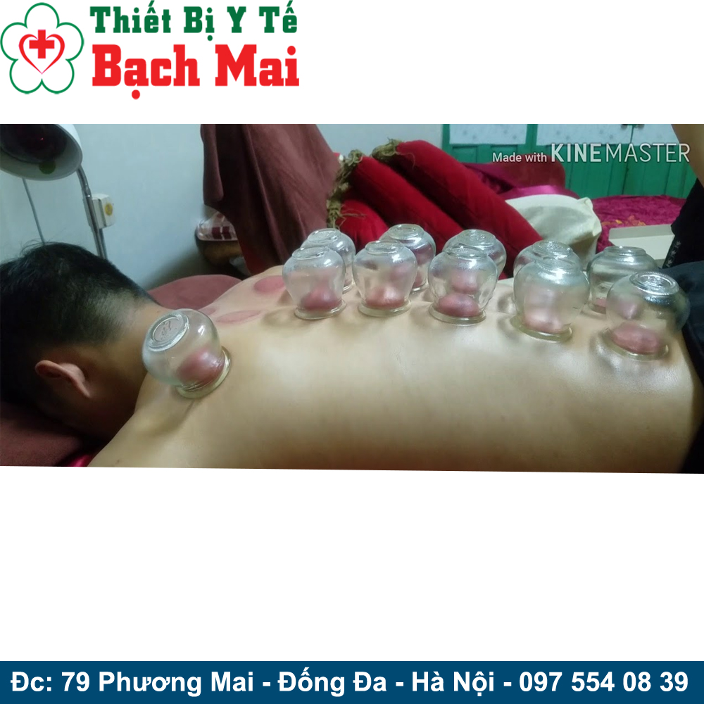 Bộ 12 Ống Giác Hơi Thủy Tinh Kèm Cây Châm Lửa